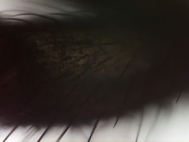 Dead baby spider leg