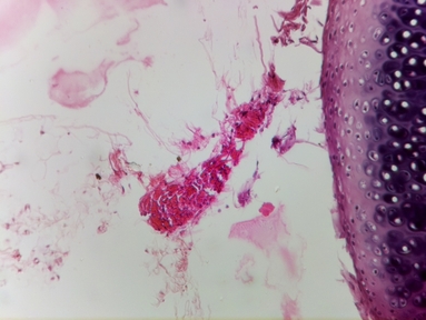 Bone tissue