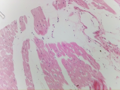 Cardiac tissue