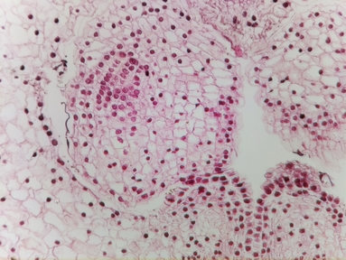 Lily ovary