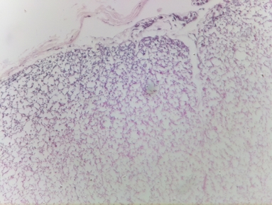 Spinal tissue